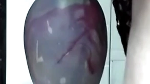 Huge insertion gapes his botheration