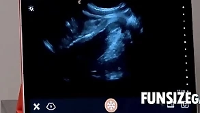 Ultra sound penetration check up on - dr wolf, austin