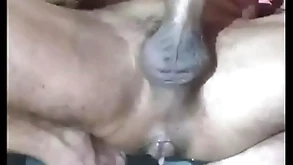 Incredibil react prostate anal scale
