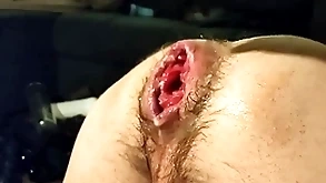 Just fisting my uninhibited cleft and prolapse:)